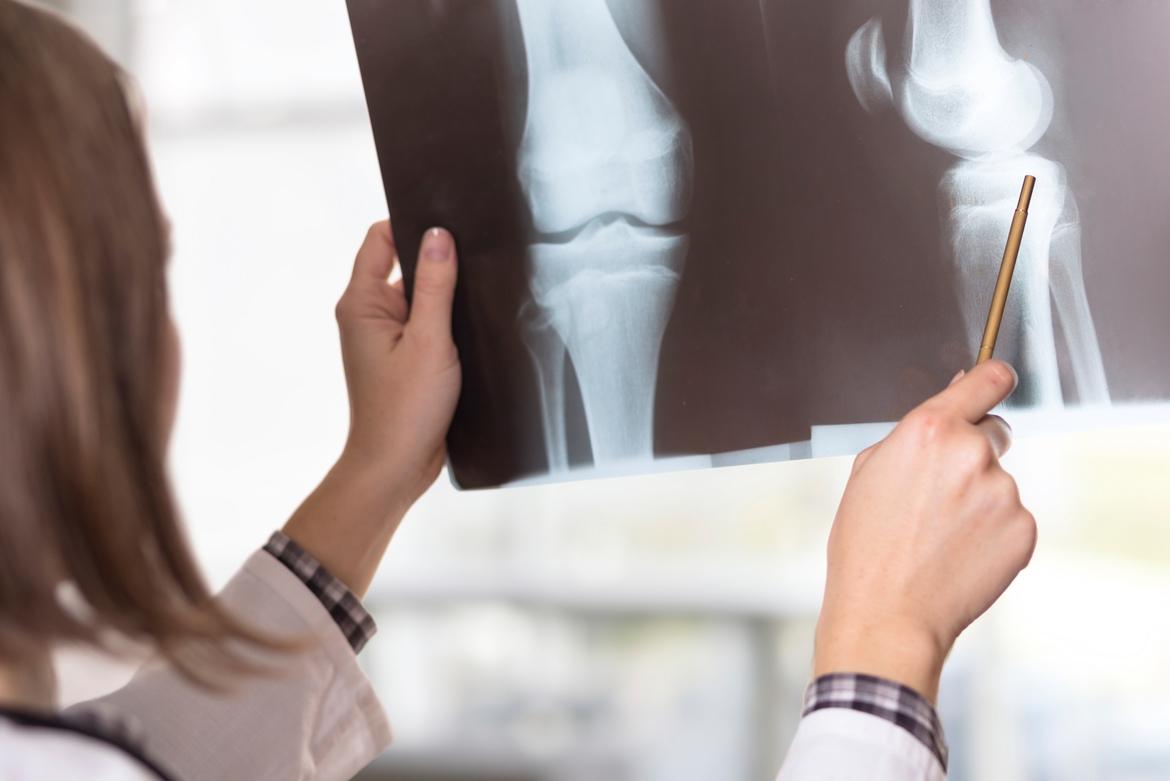 检查骨骼和关节健康的 3 种常见扫描